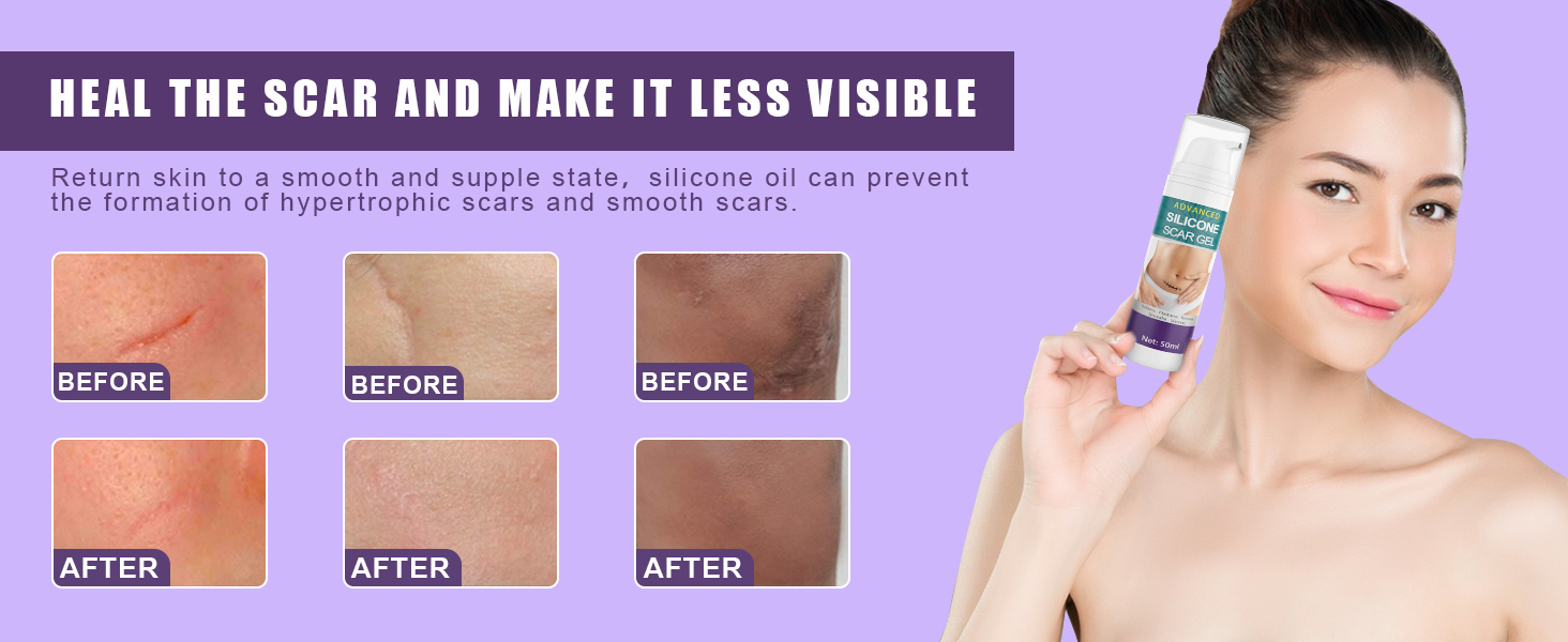 scar gel for surgical scars