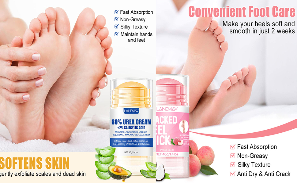 urea foot cream