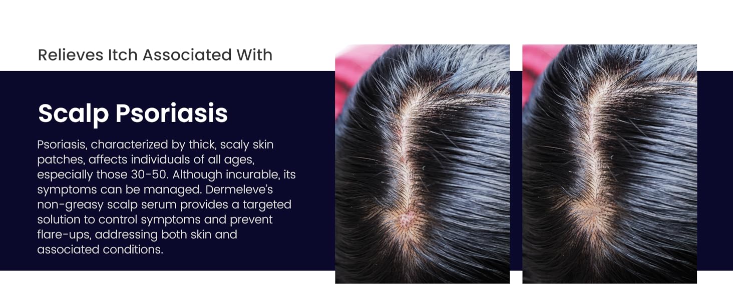 Dermeleve Anti-Itch Serum