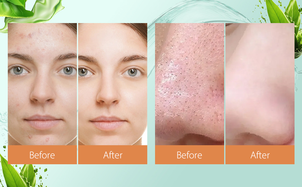 facial peeling pads