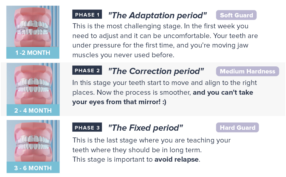 APRO Teeth SelfAligning to Straight and Perfect Your Smile. Set of 3