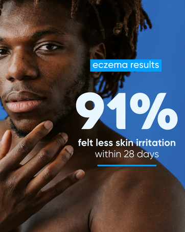 steroid free eczema cream natralia eczema & psoriasis cream moisturizer cream for eczema