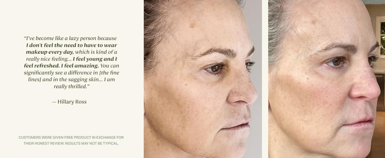 anti-wrinkle cream
