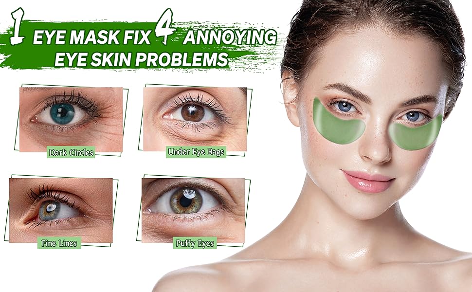 MYPROKIT Under Eye Patches for Dark Circles and Puffiness