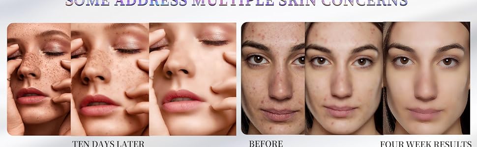 led face mask with neck