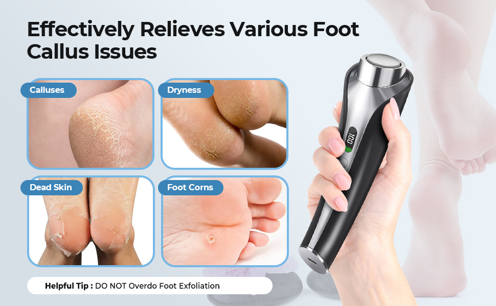 electric callus remover for feet electric foot callus remover