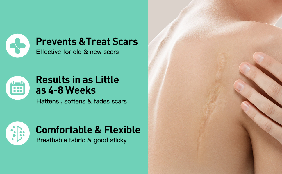 silicone scar tape