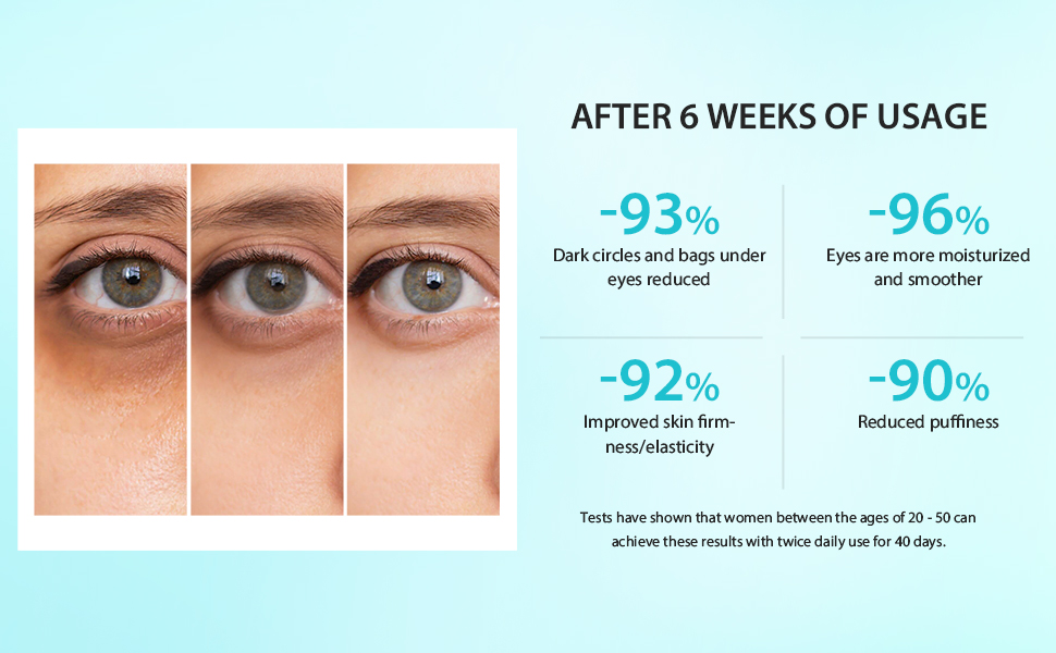 Anti-Aging & Dark Circle Treatment with Vitamin C eye cream