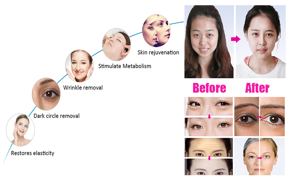 Portable Eye Facial Treatment Beauty Device