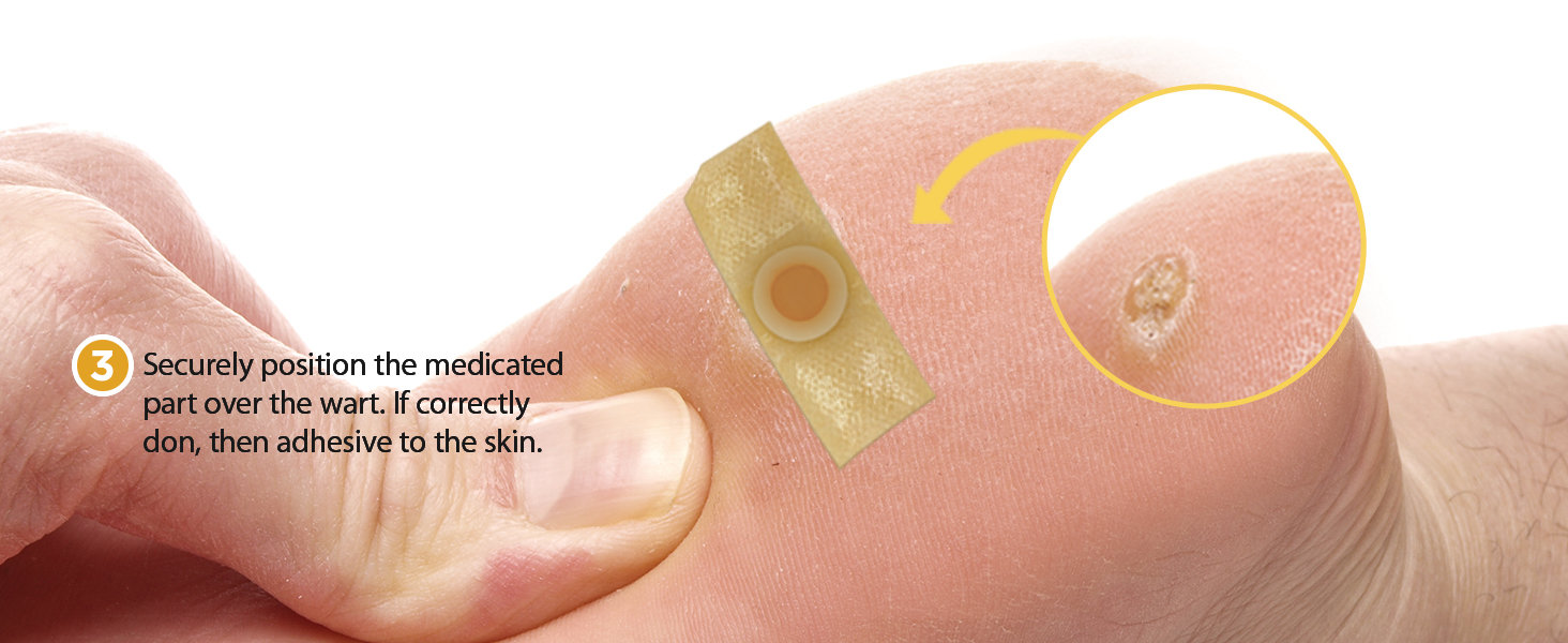 Wart Remover Bandaid FDARegistered Potent Solution for
