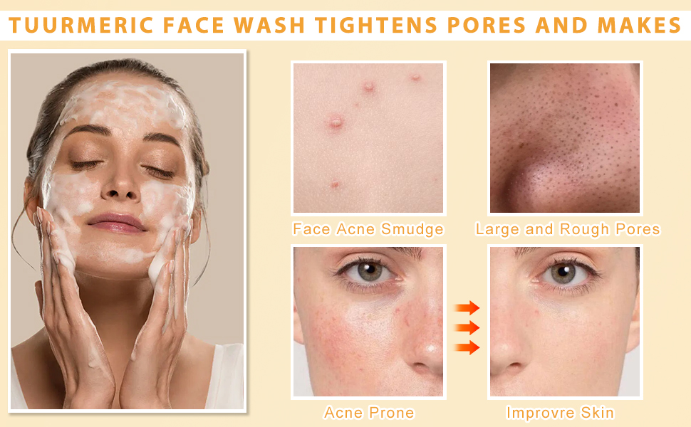 Turmeric Soap and Turmeric Facial Cleanser Can Clean All Facial Problems