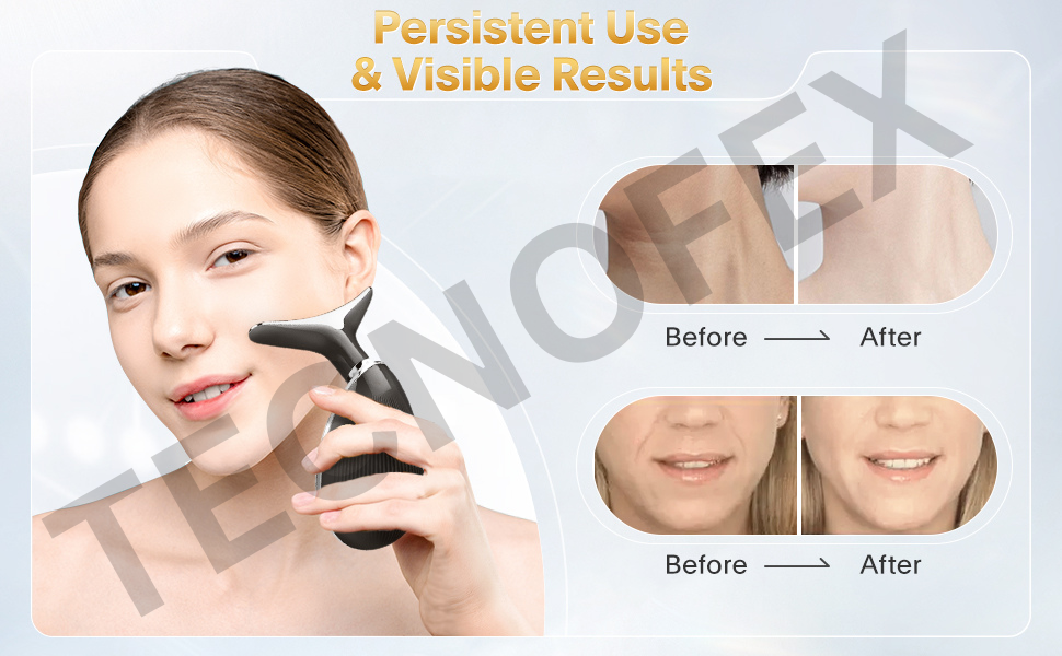 Red Light Therapy Vibration Massager Skin Rejuvenation Beauty Face Neck Lift Tight Sagging Radiant