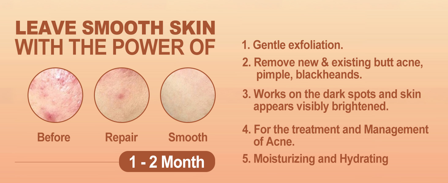 Butt Acne