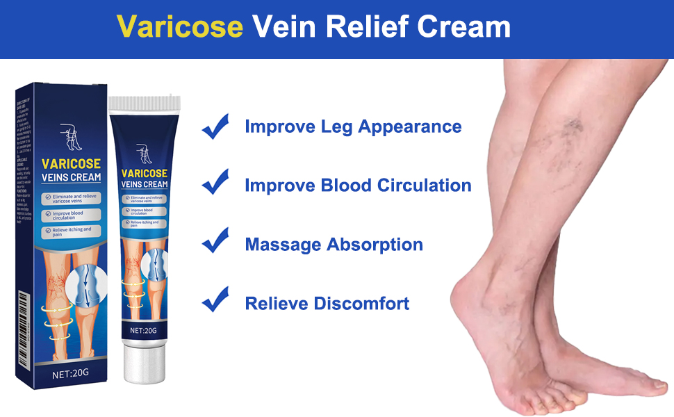 Varicose Veins Cream
