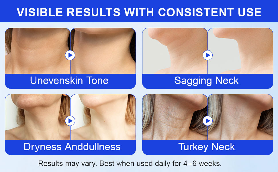 neck firming and tightening
