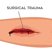 wound care products gauze sterile wound dressing wound healing silver foam combat gauze