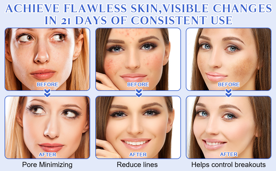 Glycolic Acid Pads,Glycolic Acid Peel Pads with 10% Ultra Pure Glycolic + 2% Salicylic Acid,Cleansing Pads for Face & Body with Vitamins B3, C & E, Green Tea, Calendula, Allantoin - 60 Pads 19 ikzee果酸棉片60p-5