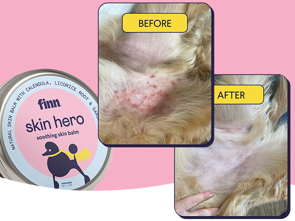Skin Hero To The Rescue! Before and After daily Skin Hero Application: Results