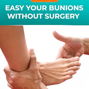 Easy your bunions without surgery