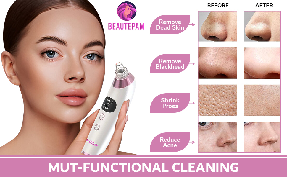 Comprehensive Guide to Pimple Extractors, Nose Strips