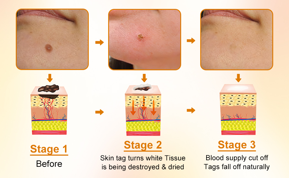 Bee Venom All-in-One Cream,Moisturize and lift 3 in 1