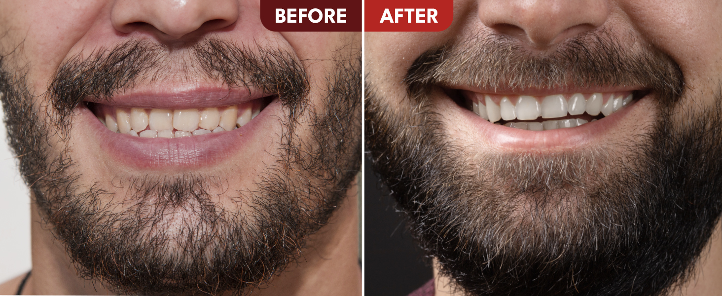 Strong Roots Men Beard + Hair Oil