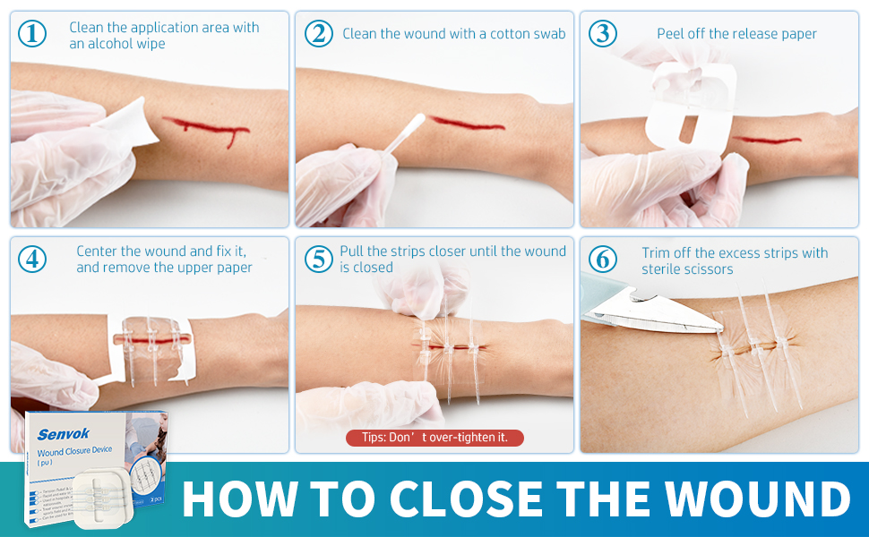 Senvok Laceration Closures Zip Stitch Butterfly Bandages Kit