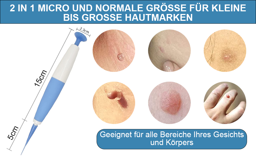 Skin Tag Entferner,Gerätestift zum Entfernen von Hautmarken, 40 Bänder SkinTag Remover Kit 24