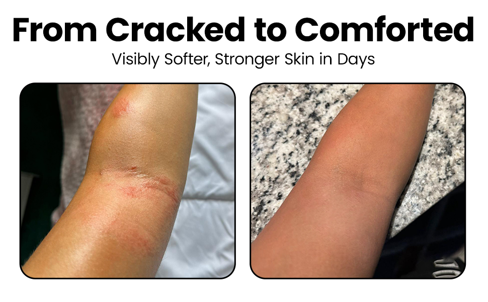 This handmade moisturiser takes your skin from being cracked to being soft so you feel comforted