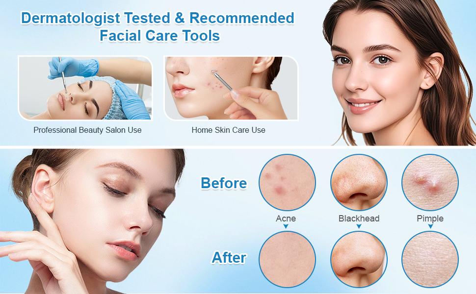 Pimple Popper Toy Pimple Popper Tool White Head Remover for Face Blackhead Remover Tool