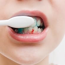 will hurt the gums?