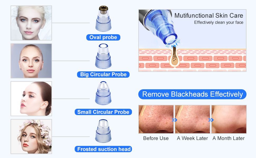 REMOVE BLACKHEAD