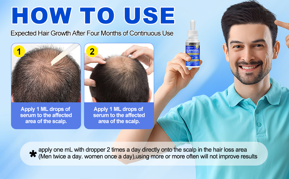Minoxidil for Men