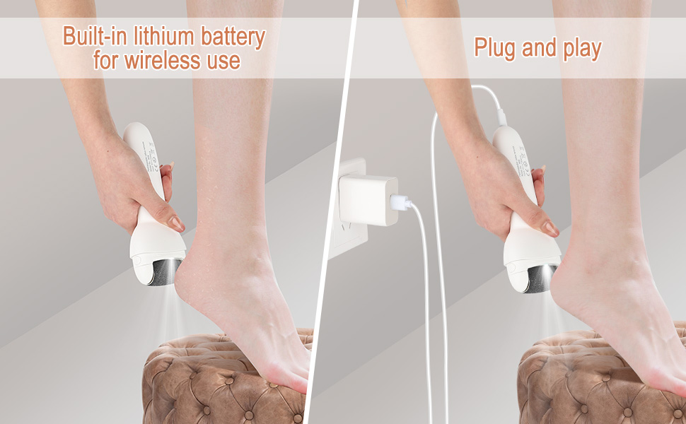 foot file callus remover