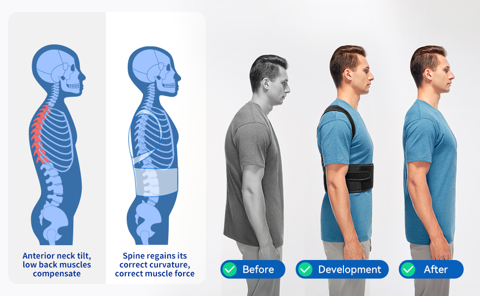 posture corrector for men