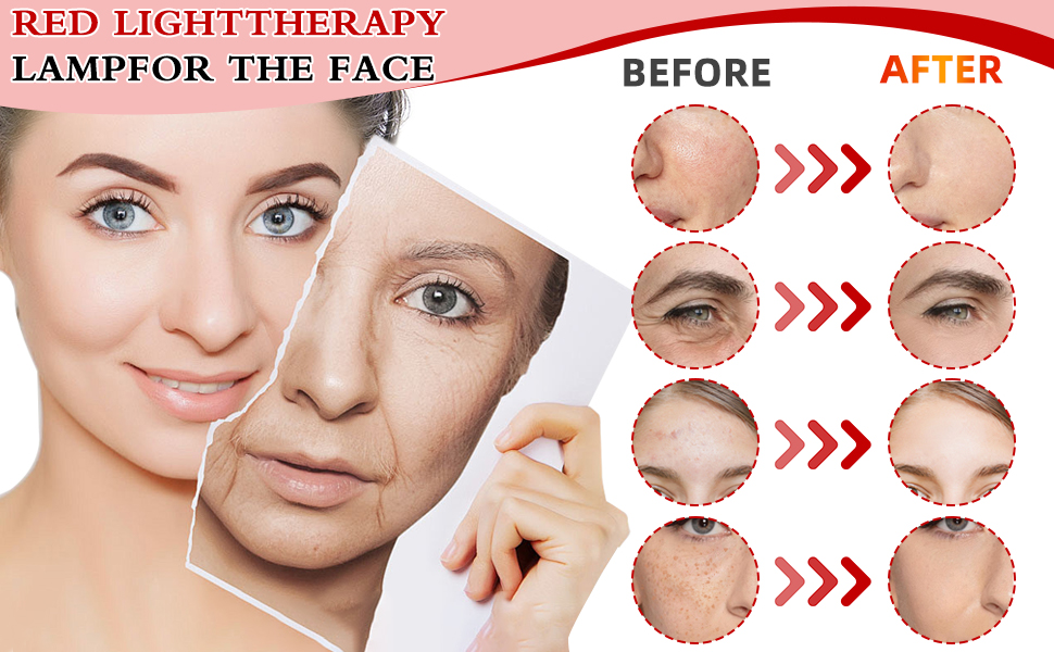 red light therapy for body