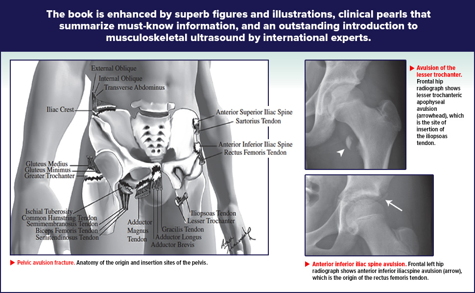 Basic Musculoskeletal Imaging, Second Edition: 9781260459975