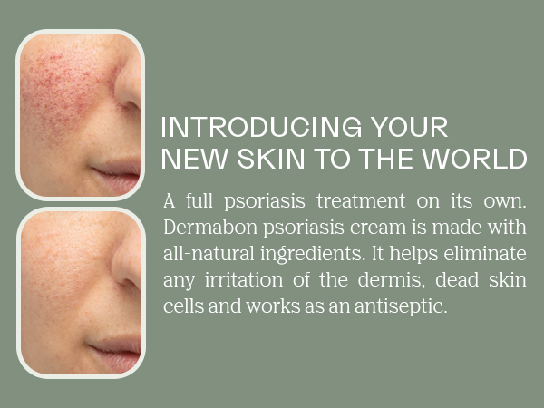 Adult Eczema Therapy, Hydrating Skin Lotion, Comprehensive Care for Dry Skin