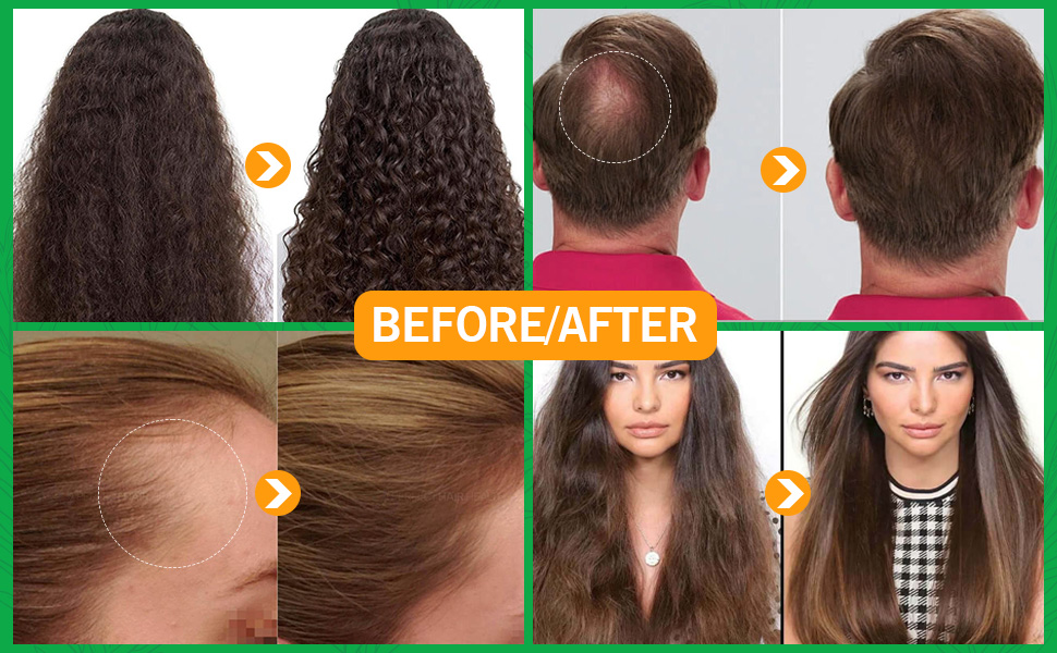 hair care product