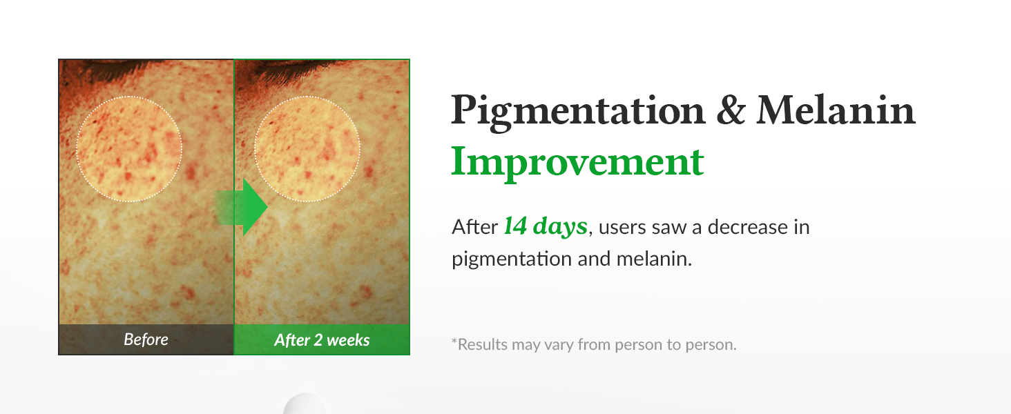 8ea5aa77-7ffd-4d1b-9ff8-7a7aa5be1f22.__CR0,0,1464,600_PT0_SX1464_V1___.jpg (1464×600)