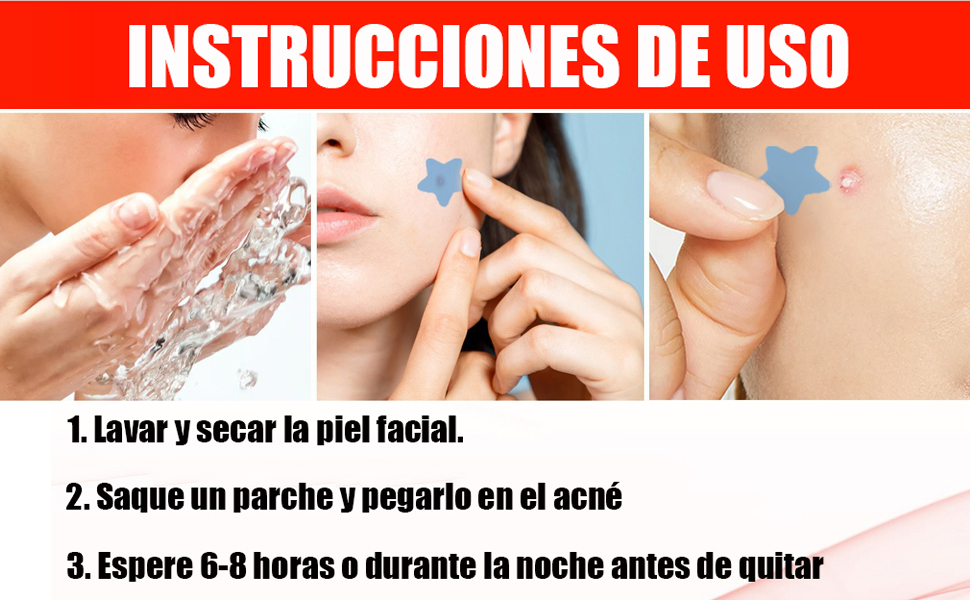 Parches para Acne