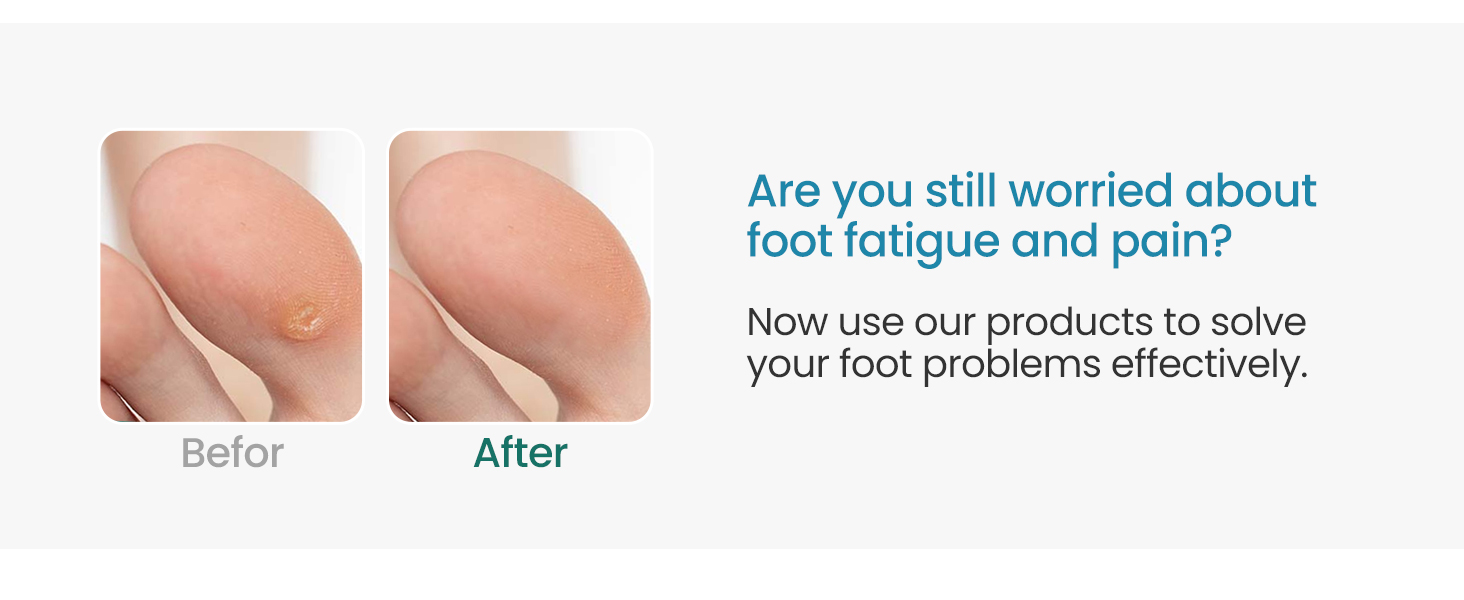 corn pads toes feet callous callus cushions for bottom of foot relive pain pressure blister foam