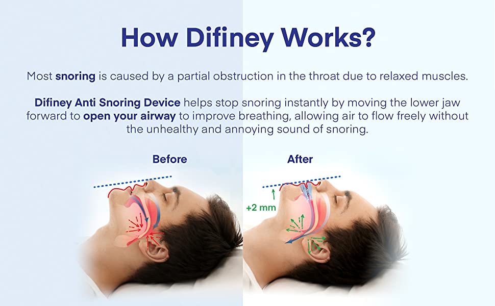 Anti Snoring Devices, Snoring Solution Snore Stopper, Stop Snoring