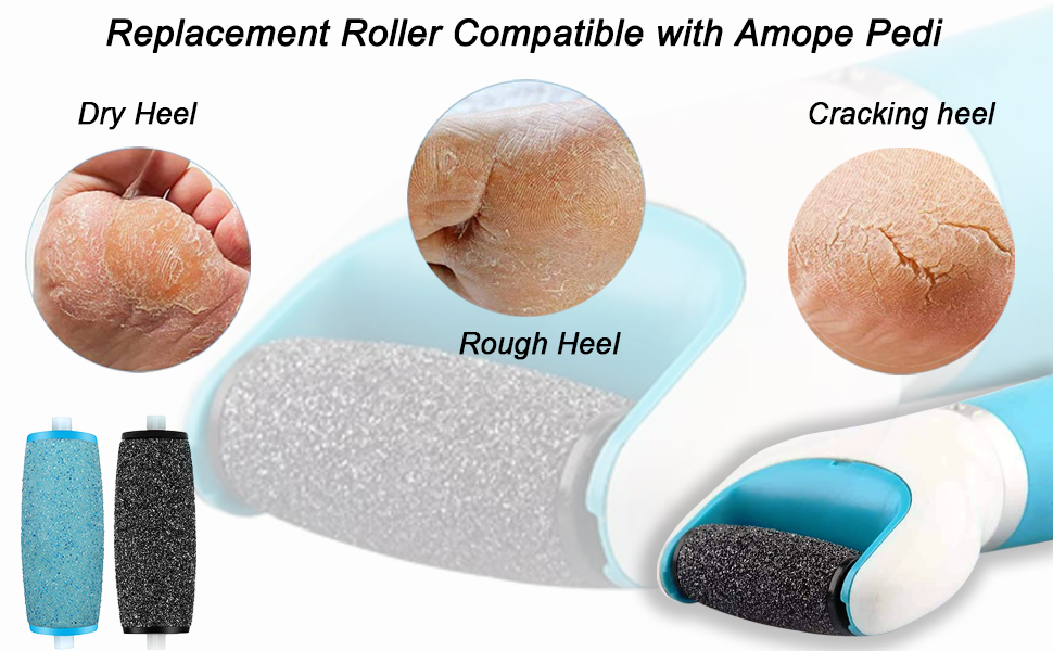 amope replacement rollers