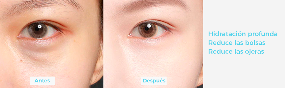 Reduce las ojeras
