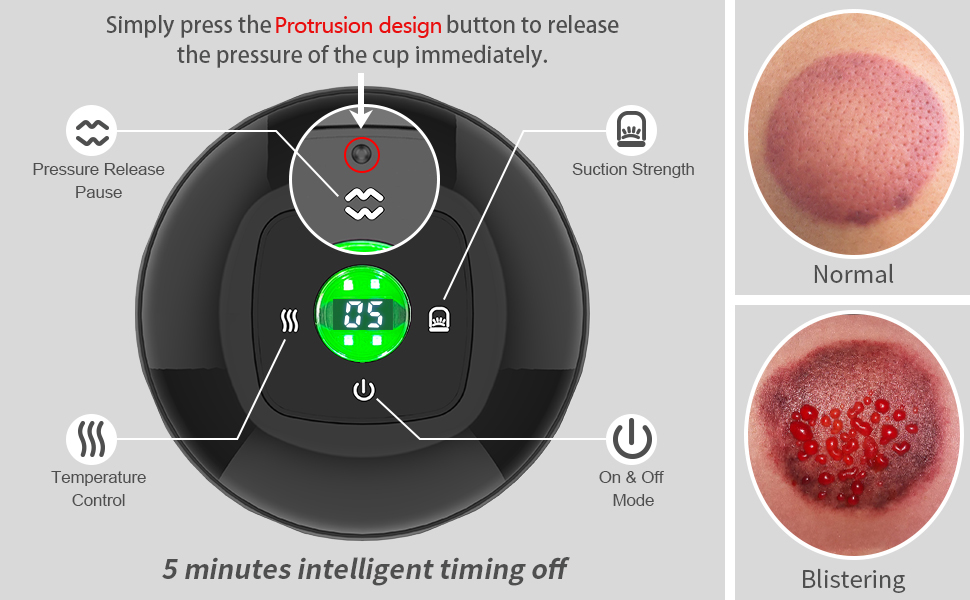Intelligentes Schröpftherapie-Massagegerät
