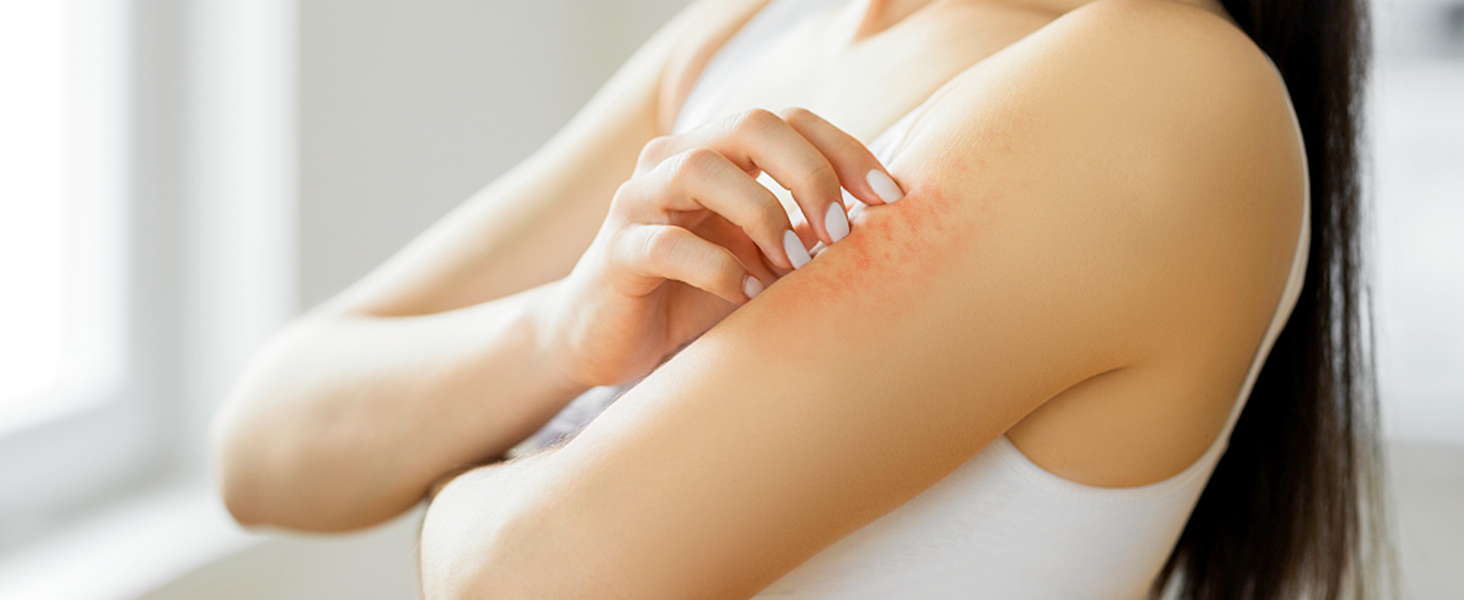 Eczema Cream