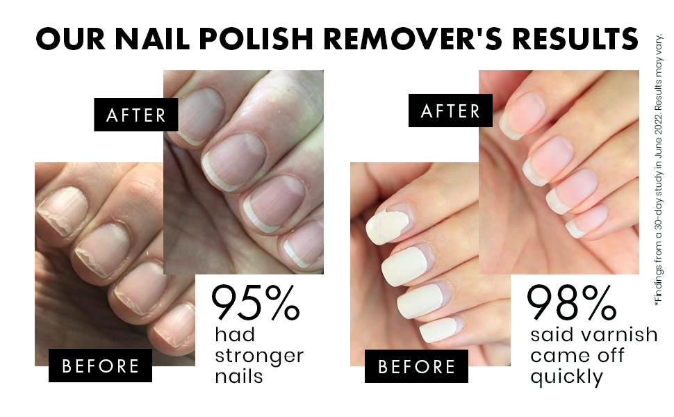 Nail Polish Remover Acetone Free Nail Polish Remover for Quick Dry