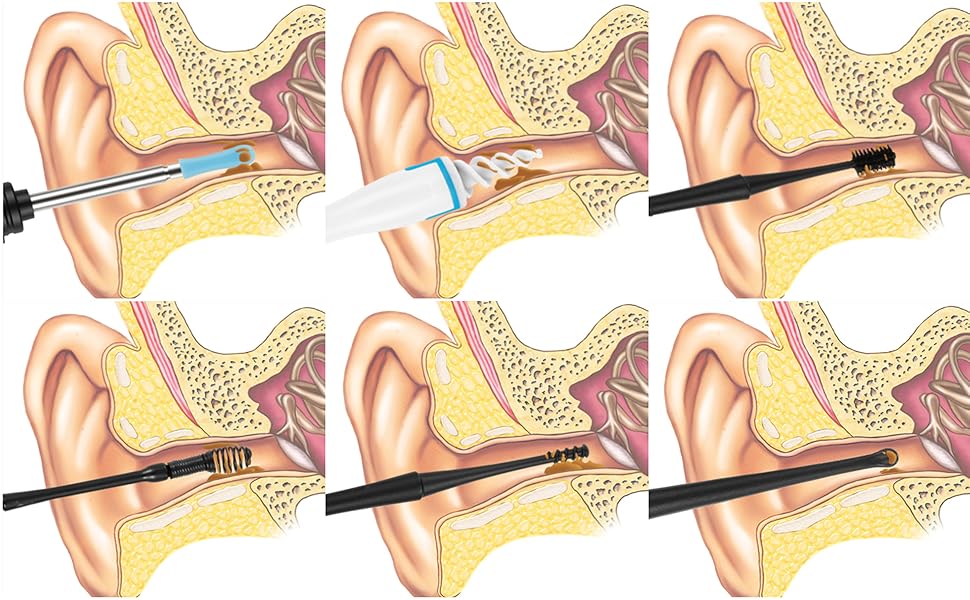 ear cleaner with cameras and light