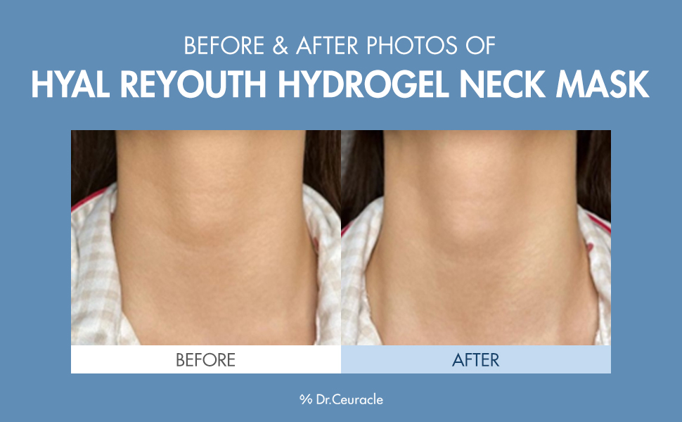 Amazon.com : Dr.Ceuracle Hyal Reyouth Hydrogel Neck Mask 10EAㅣ ...